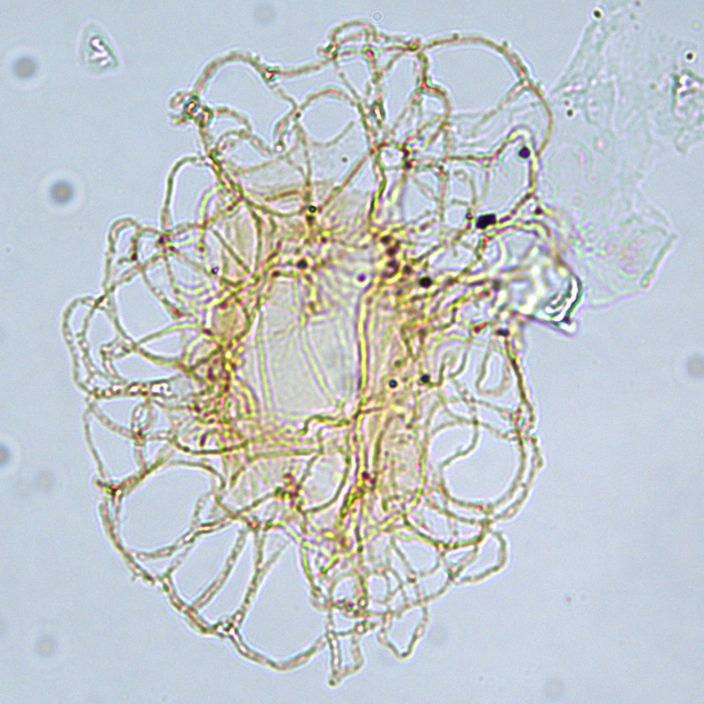 Nematosphaeropsis densiradiata, U1581-68R-CC, sl.1, F30-2, foto4.jpg